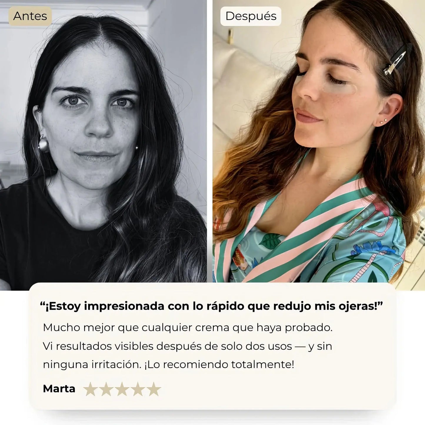 GlowEye - Elimina Las Ojeras Glowify