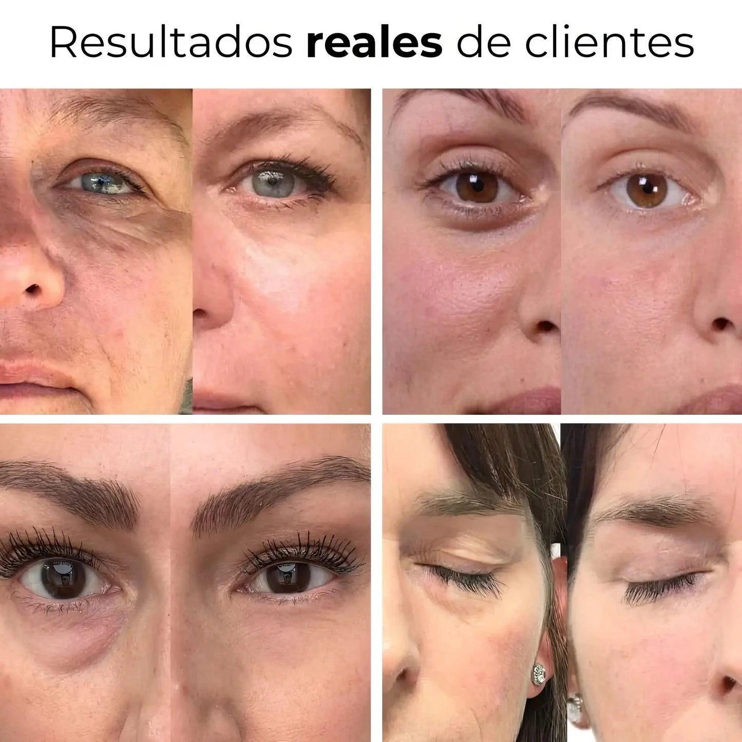 GlowEye - Elimina Las Ojeras Glowify