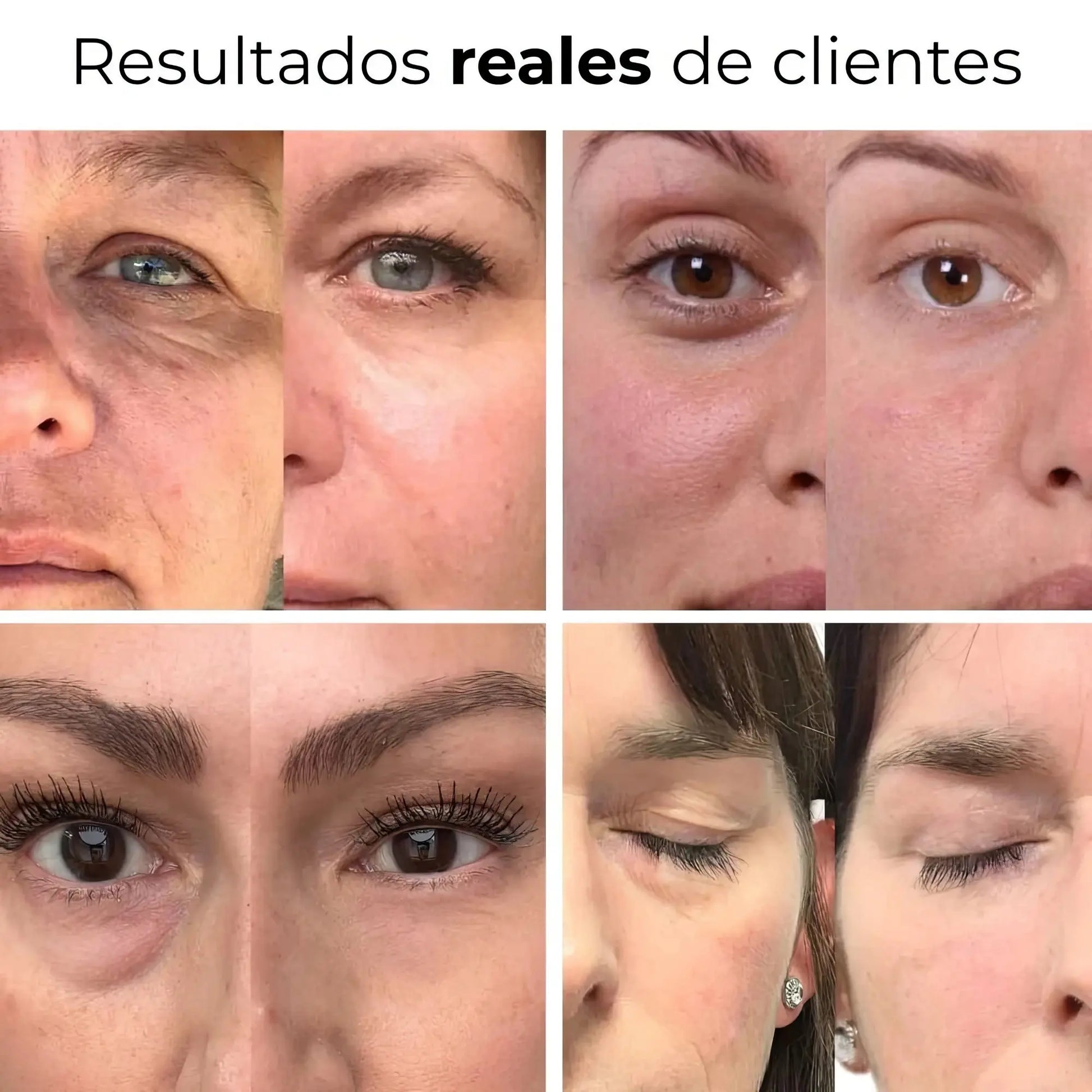 GlowEye - Elimina Las Ojeras Glowify