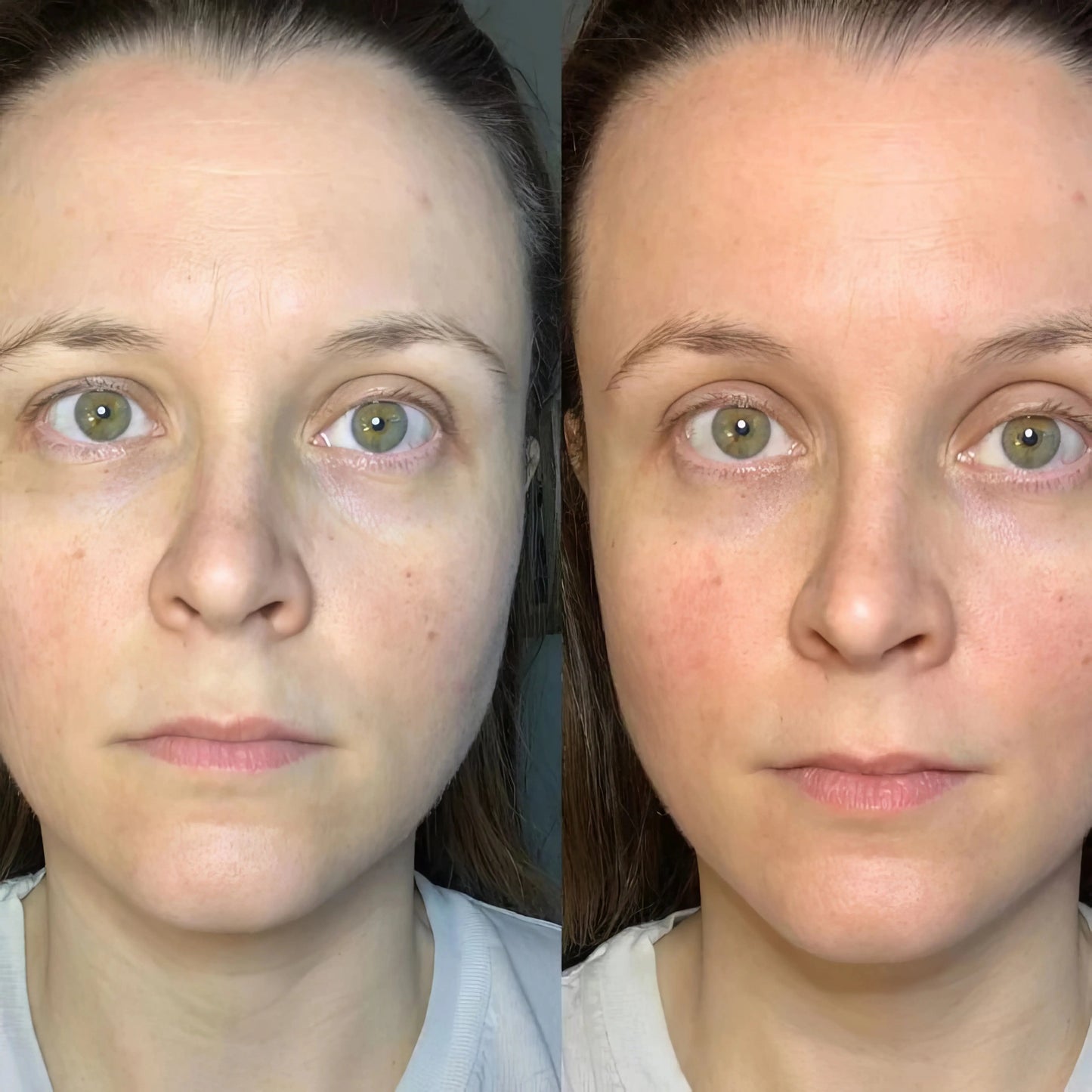 LymphGlow - Brocha de Drenaje Linfatico Facial Glowify