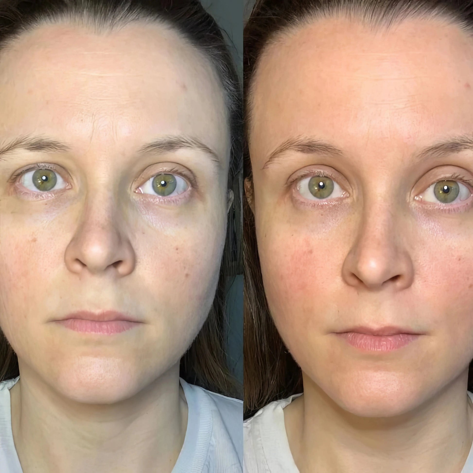 LymphGlow - Brocha de Drenaje Linfatico Facial Glowify