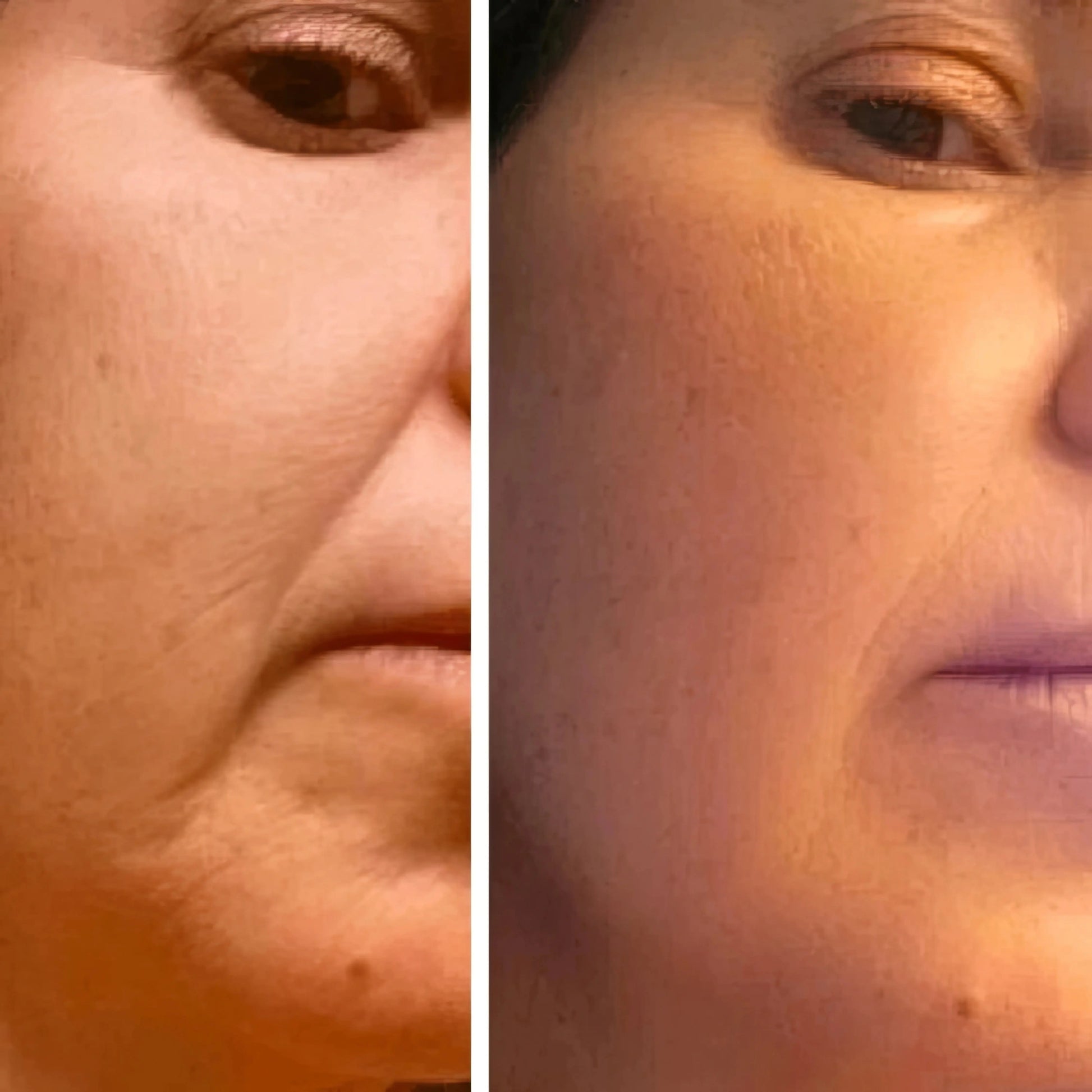 LymphGlow - Brocha de Drenaje Linfatico Facial Glowify