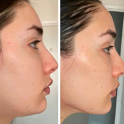 LymphGlow - Brocha de Drenaje Linfatico Facial Glowify